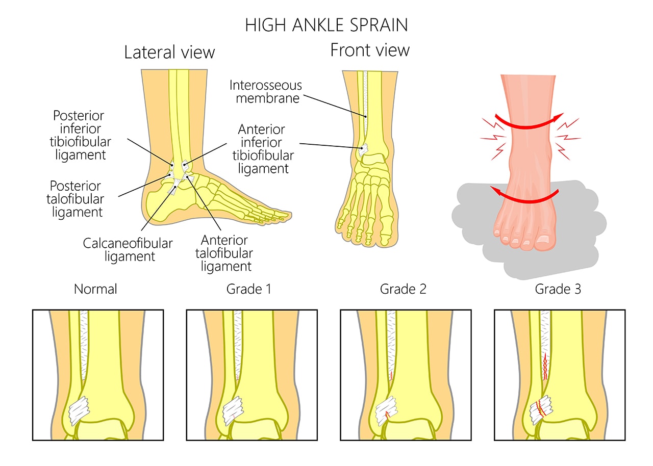 Brunson's Ankle Sprain: Recovery And Sunday's Game Outlook Brunson's Ankle Sprain: Recovery And Sunday's Game Outlook