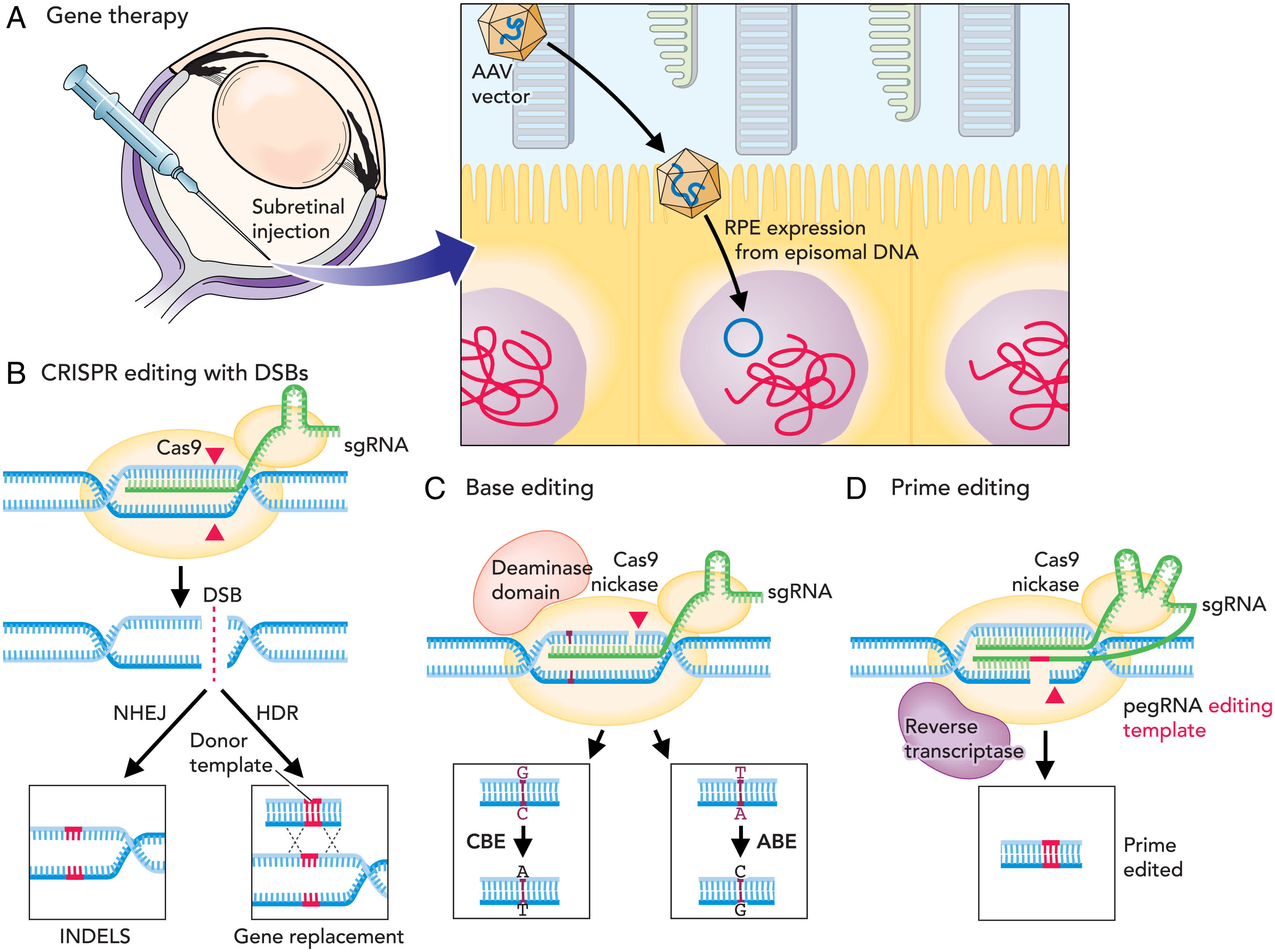 Complete Gene Insertion: Advances In Precise Gene Editing Technology Complete Gene Insertion: Advances In Precise Gene Editing Technology