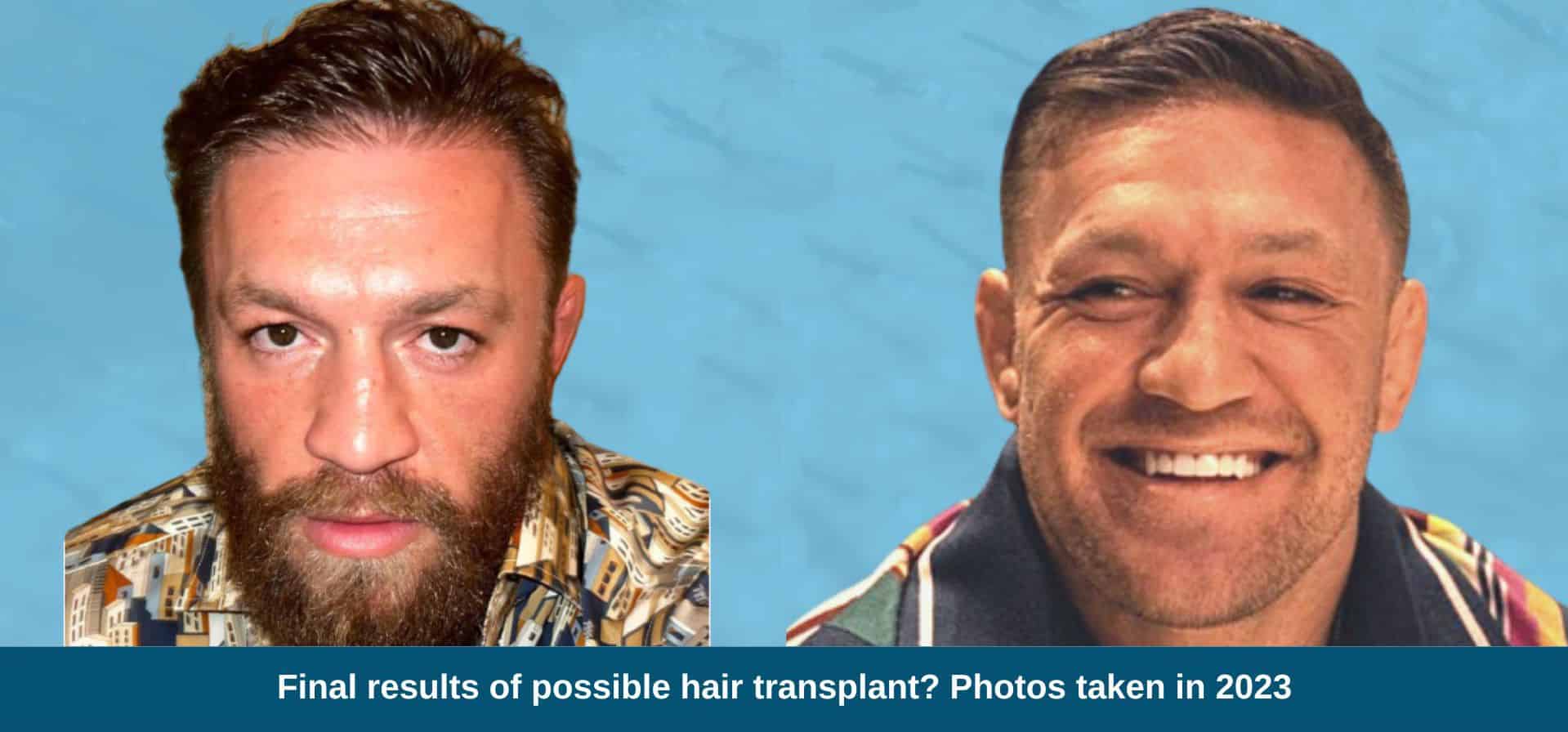 Conor McGregor's Statements On Fox News: Fact Check And Analysis Conor McGregor's Statements On Fox News: Fact Check And Analysis