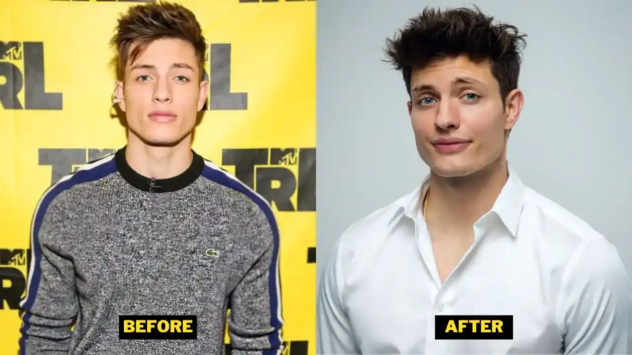 Fans Debate: Plastic Surgery Or Weight Loss Behind Pedro Pascal's Jawline Transformation? Fans Debate: Plastic Surgery Or Weight Loss Behind Pedro Pascal's Jawline Transformation?