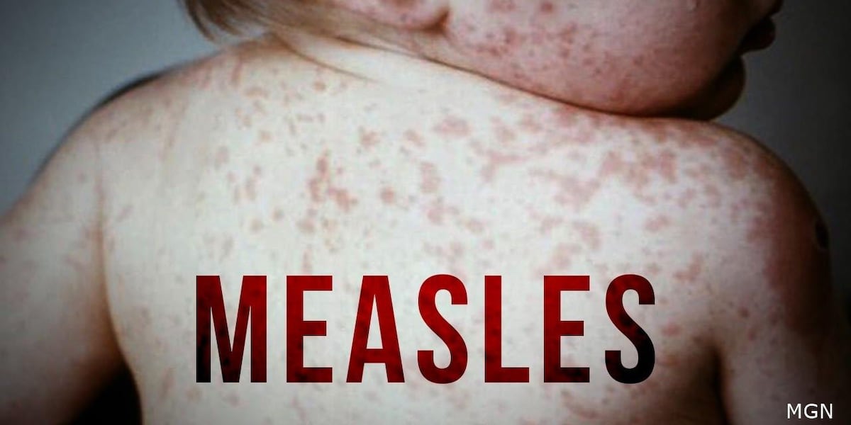 Kansas Measles Outbreak Grows: Six New Cases Reported Kansas Measles Outbreak Grows: Six New Cases Reported