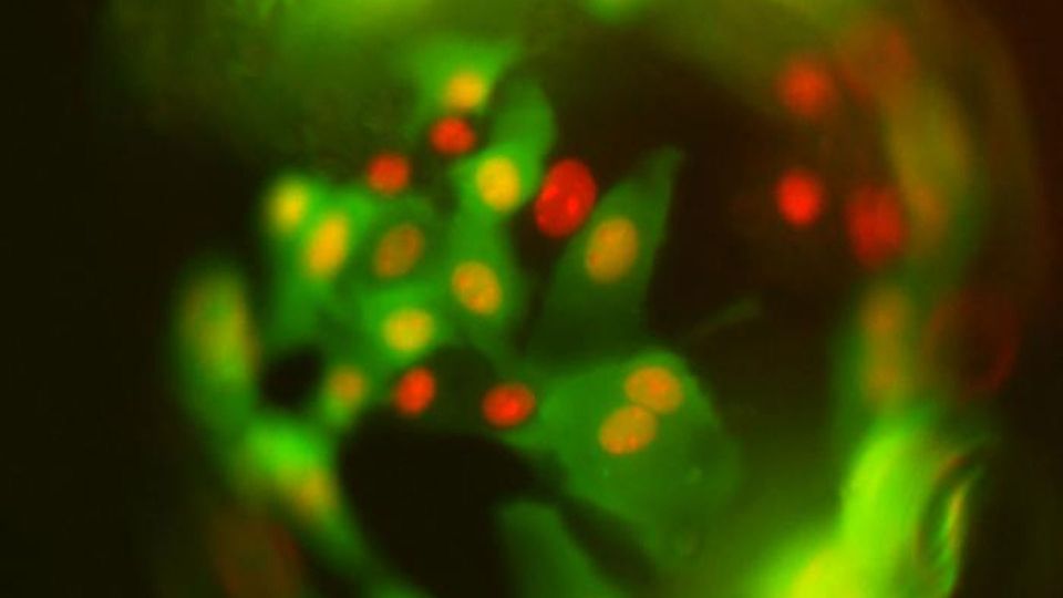 Precise Gene Editing: Advanced Tools For Complete Gene Insertion Precise Gene Editing: Advanced Tools For Complete Gene Insertion