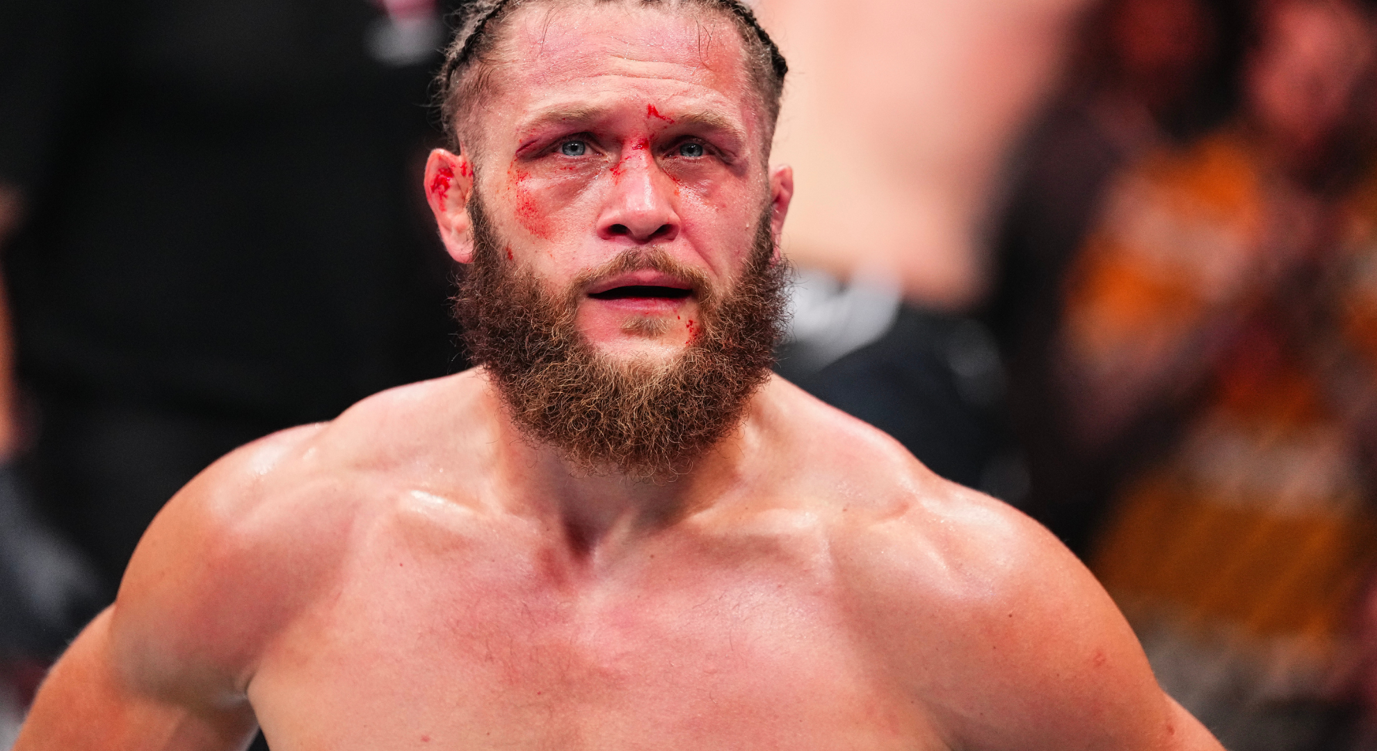 UFC 313 Controversy: Fighter Admits Defeat Following UFC 313 Controversy: Fighter Admits Defeat Following