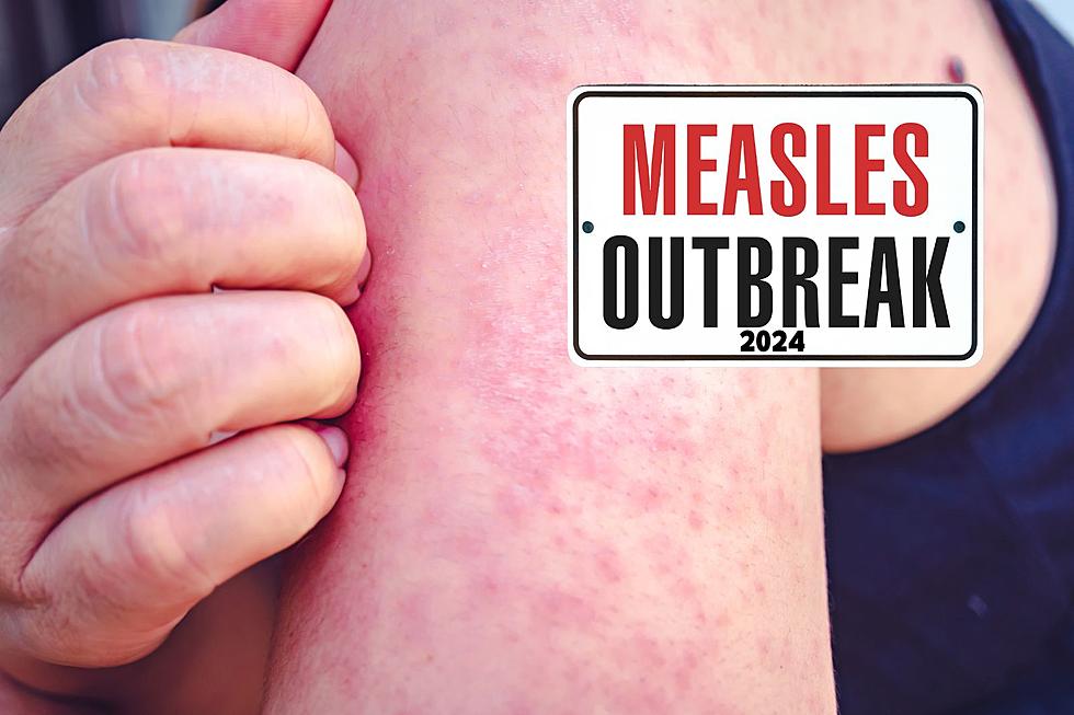 US Measles Cases At 1,046 Following Indiana Outbreak Conclusion US Measles Cases At 1,046 Following Indiana Outbreak Conclusion