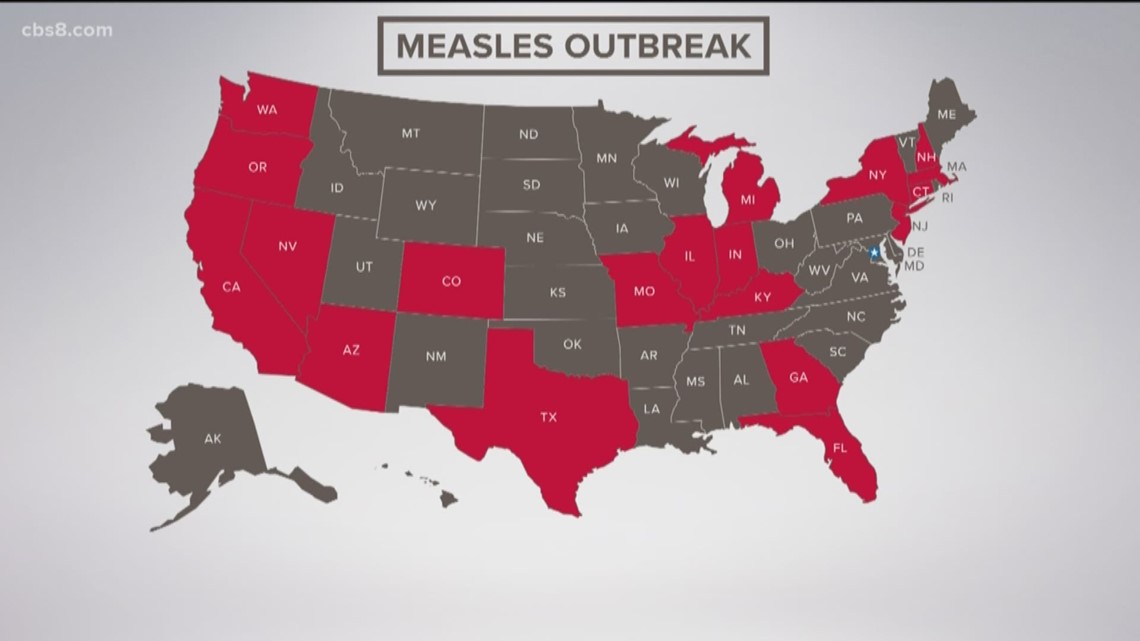 US Measles Cases Increase Slightly To 1,046; Indiana Outbreak Ends US Measles Cases Increase Slightly To 1,046; Indiana Outbreak Ends