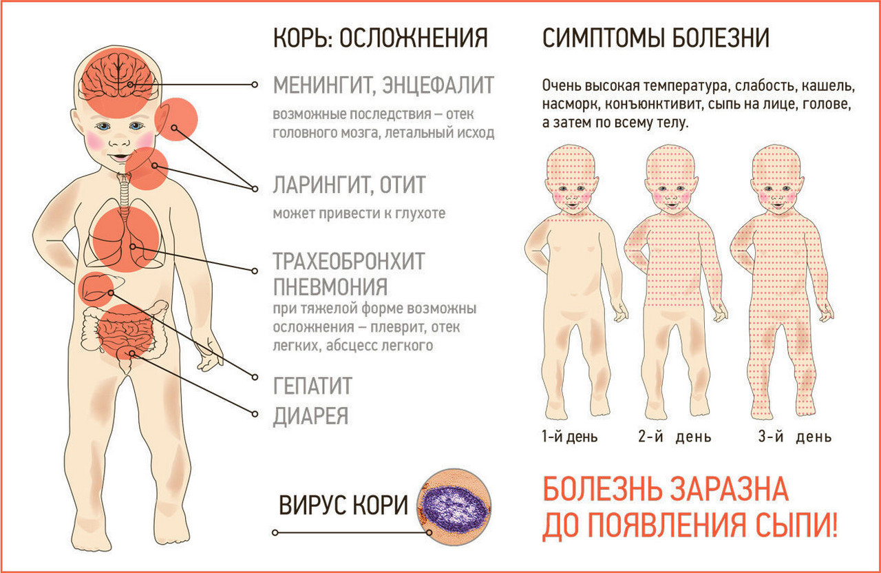 Заражение Корью В Монголии: Экстренный Призыв К Действиям Заражение Корью В Монголии: Экстренный Призыв К Действиям